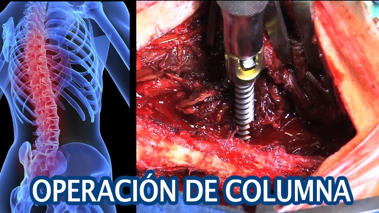 OPERACIÓN DE COLUMNA