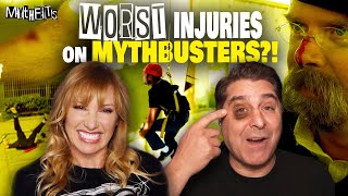 Mythbusters Drama: The Worst Injuries On Set