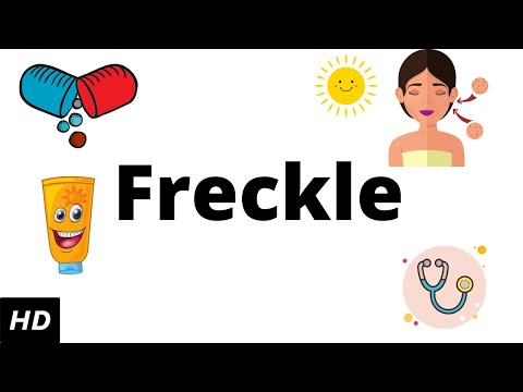 Freckle, Causes, Signs and Symptoms, Diagnosis and Treatment.