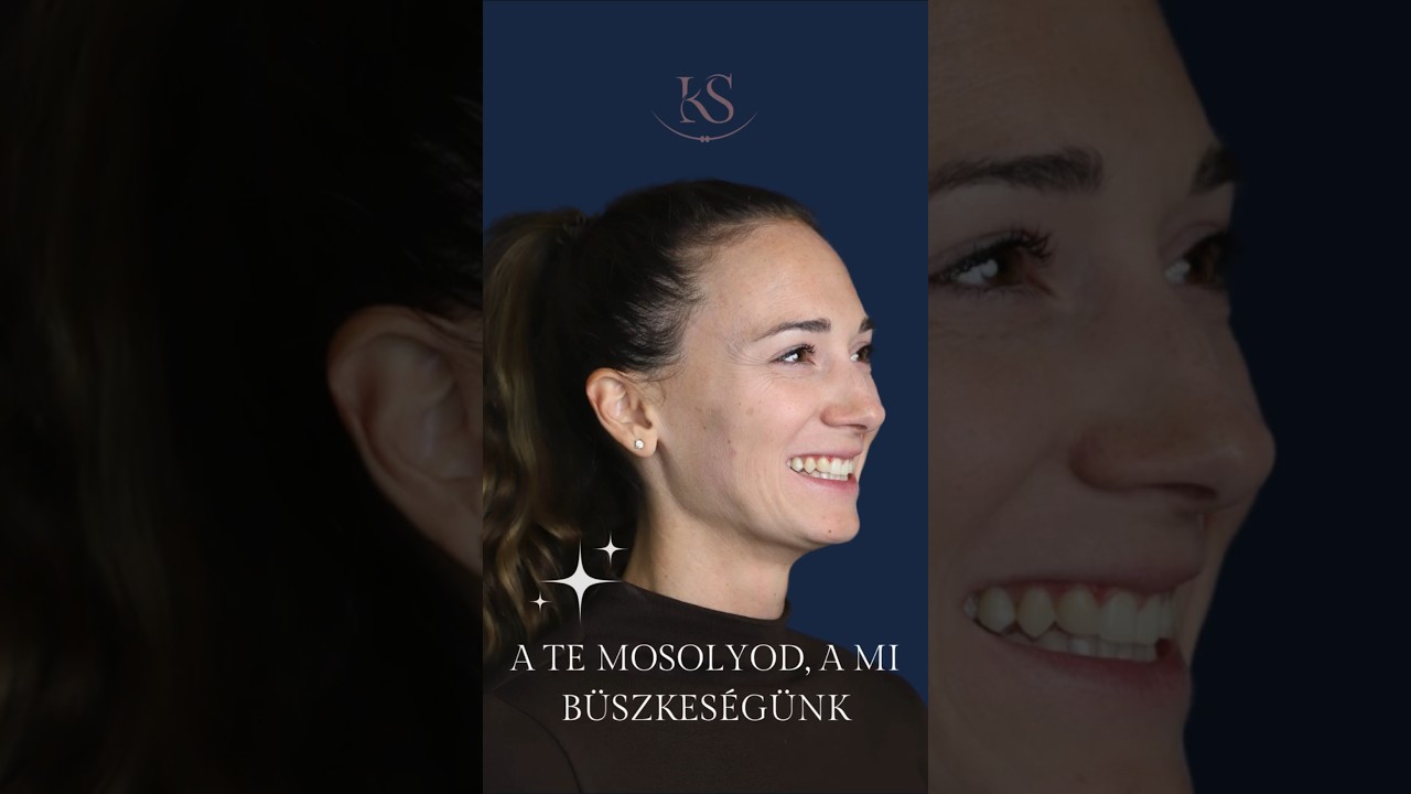 Elképesztő változás! 🤍 - ✨ VANDA MOSOLYA ✨és a fogszabályozás ereje - Dr. Kovács Sarolta szakorvos