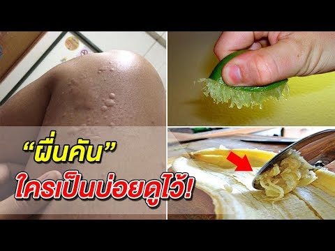 เพิ่มสมาชิกที่เป็นอิสระ ชีสเพิ่มความแข็งแรงในผู้ชาย