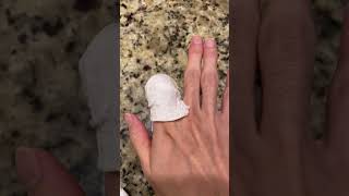 You MUST DO THIS if you cut off your finger - Save your finger while you can!!