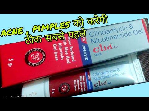 Clid gel for acne uses in hindi || clindamycin & Nicotinamide gel review in hindi