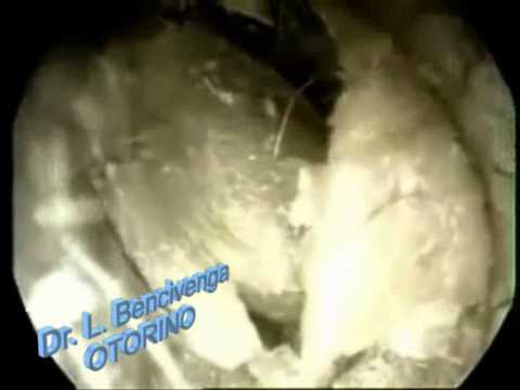 Dermatite di atopic bilirubin Il pigmentary nota a dermatite atopic