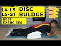 L4 L5 L5 S1 Disc Bulge Best Exercise Rehabilitation For Pain Relief