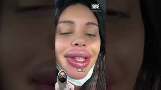Download lagu Kok Bisa Sebesar Itu Ya Bibirnya? #shorts mp3