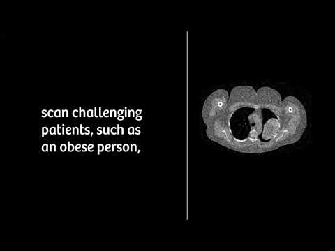 Siemens SOMATOM Force