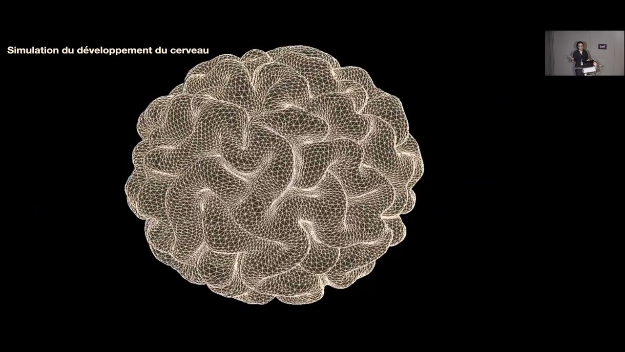 Conférence Grands donateurs, 21 mai 2026 : quand le cerveau se trouble…