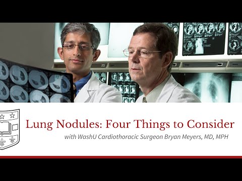 Lung Nodules: Four Things to Consider with Bryan Meyers, MD, MPH