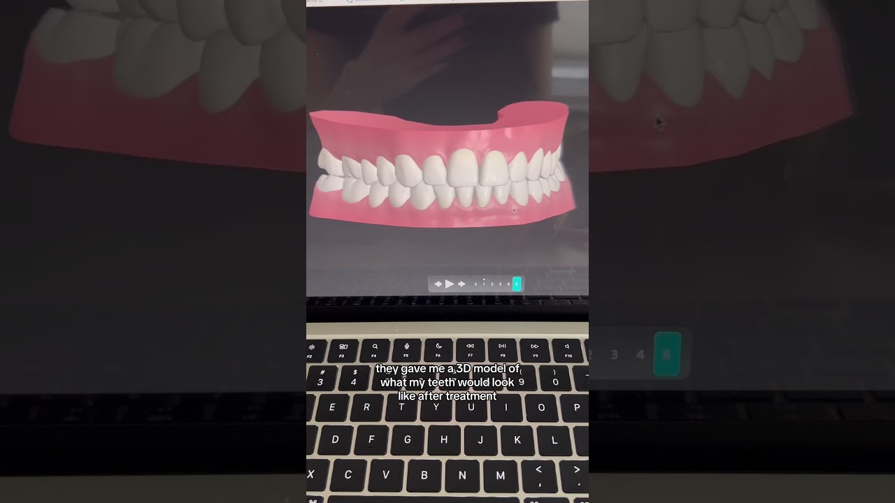 come with me to get invisalign 😬🦷✨ #Shorts