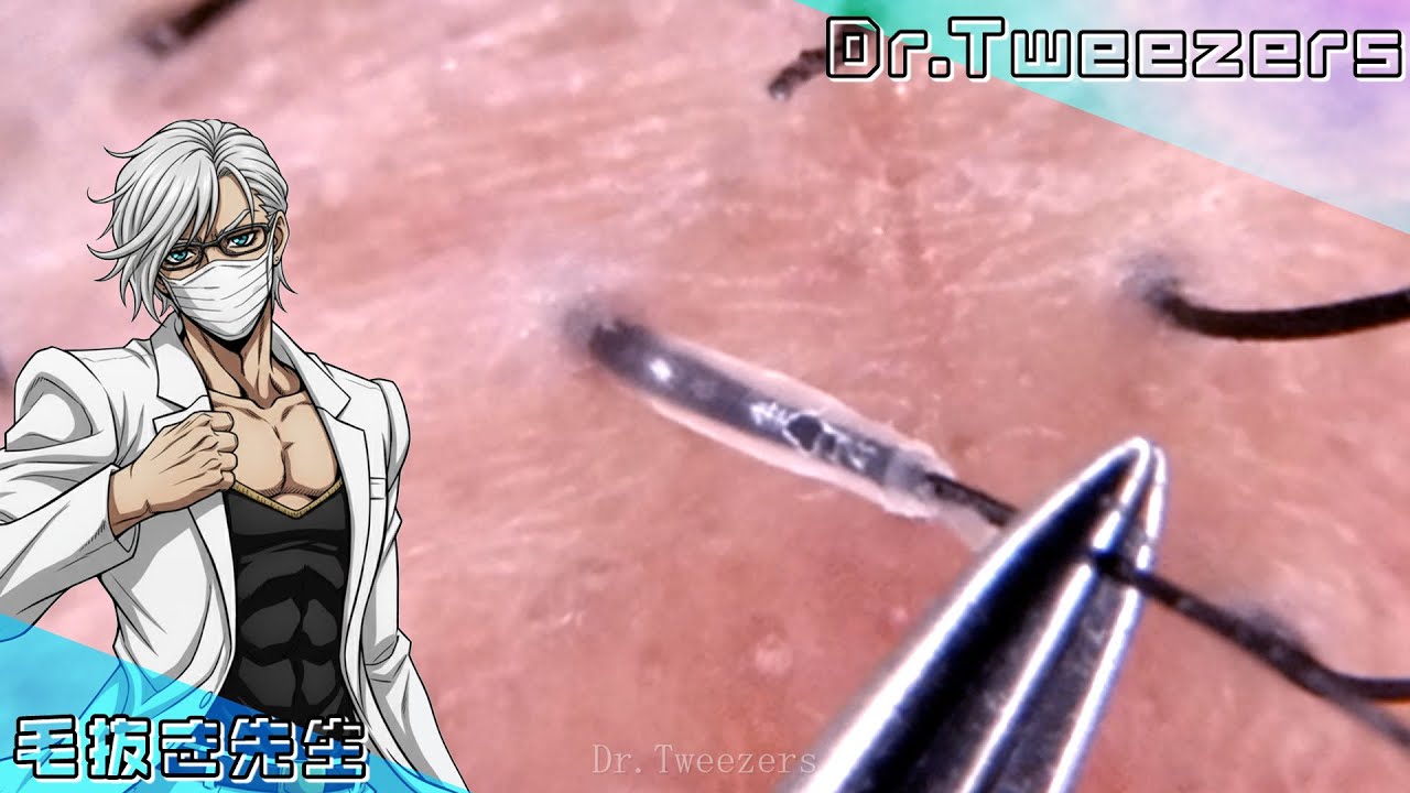 I will pull out 30 hairs.