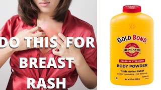 SUFFER NO MORE WITH  Under- the -Breast Rash