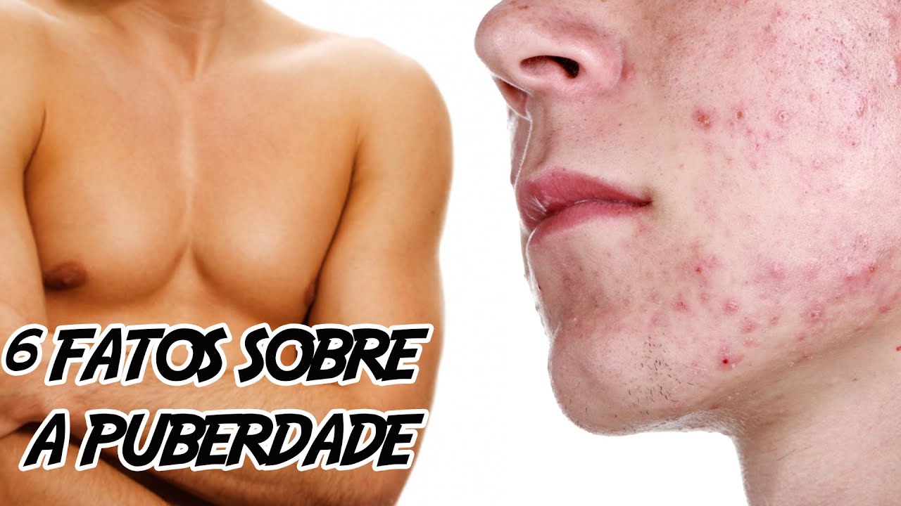5 Fatos sobre a Puberdade (que nunca te contaram)