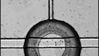 Neutrophil chemotaxis in a microfluidic device [Folch lab]