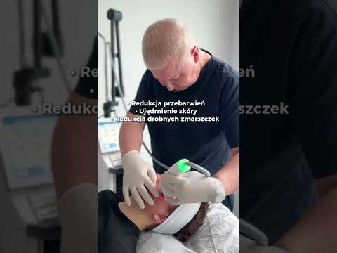 🤍 Laserowe odmładzanie, redukcja przebarwień ✨