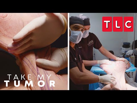 Alexandra's Tumor Removal Surgery | Take My Tumor | TLC