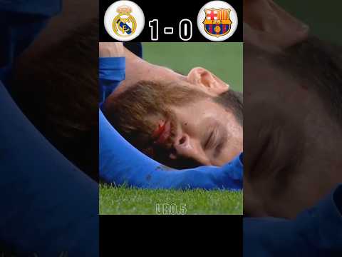 The day Messi got injured and became unstoppable