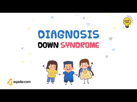 Down Syndrome Case Study | Chromosome 21 Trisomy | Pediatric Lecture | Diagnosis