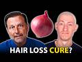 Onion Juice For Extreme Hair Growth Stop Hair Loss Hair Surgeon Reacts