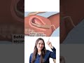 Perjuangan Seorang Ibu Hamil Medikacare