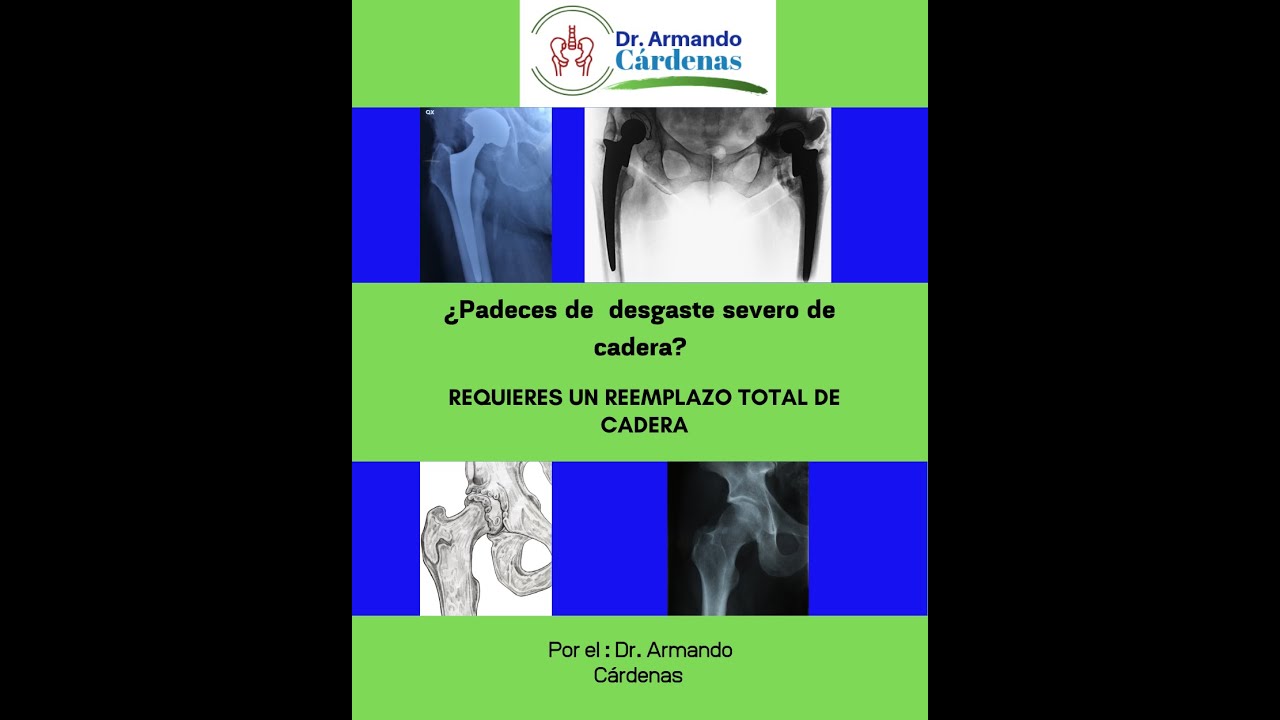 Rey Armando Cárdenas Acuña-11