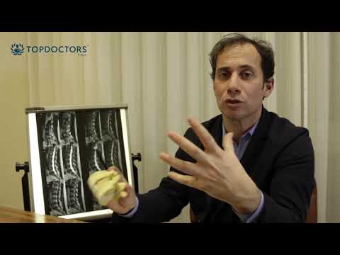 Ginocchio scatta cosa si tratta Deformando osteoartrite del ginocchio diagnosi