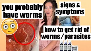 HOW TO KNOW IF YOU HAVE WORMS + HOW TO GET RID OF WORMS | PARASITE DETOX ROGERSHOOD PARAFY CLEANSE