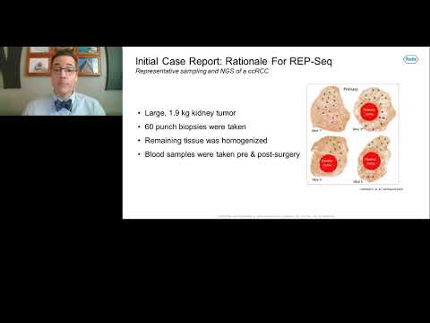 Representative sampling to address tumor heterogeneity