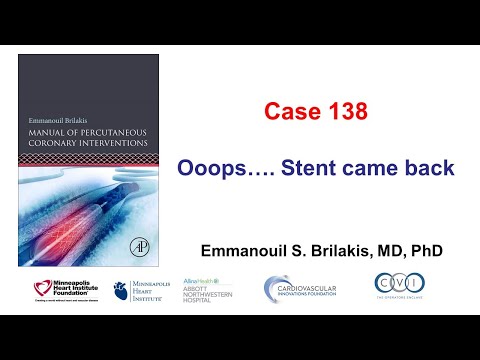 Case 138: PCI Manual - Oooops...  The stent came back