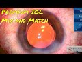 Refractive Surgery with Premium IOL Mix and Match of Vivity and Panoptix lenses for optimum vision