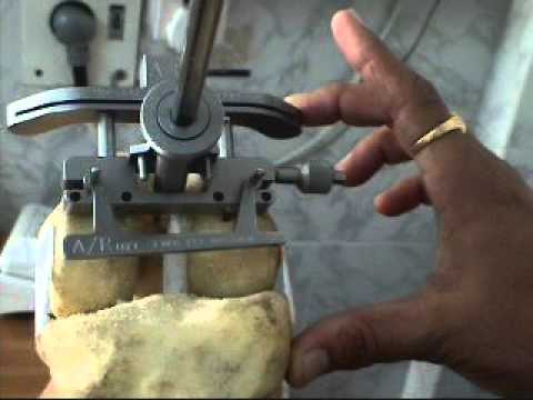 download lagu mp3 mp4 Dr Milind Patil Thane Contact Number, download lagu Dr Milind Patil Thane Contact Number gratis, unduh video klip Dr Milind Patil Thane Contact Number