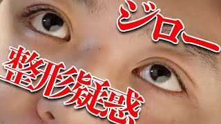ジローの整形疑惑について話します