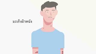 CHULA MOOC: ผิวหนังและแสงอาทิตย์