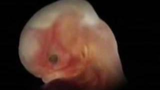 Antony and the Johnsons &quot;Fistful of Love&quot;