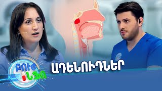 Բուժ ինֆո/Buj Info/Խորհուրդ ծնողներին/ Ադենոիդներ