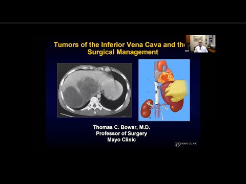 Tumors of the Inferior Vena Cava and their Surgical Management