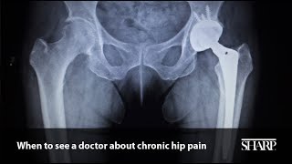 When to See a Doctor about Chronic Hip Pain
