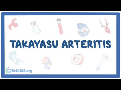 Takayasu arteritis: Year of the Zebra 2026