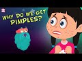 Why Do We Get Pimples The Dr Binocs Show Best Learning Videos For Kids Peekaboo Kidz