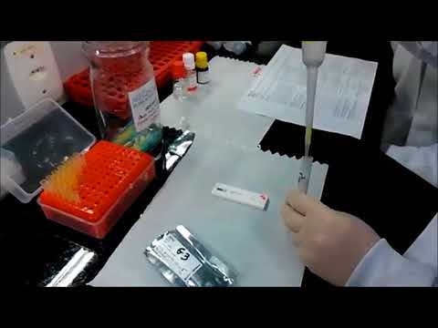 HBsAg (Ag de superficie)-PRUEBA RAPIDA HEPATITIS "B"