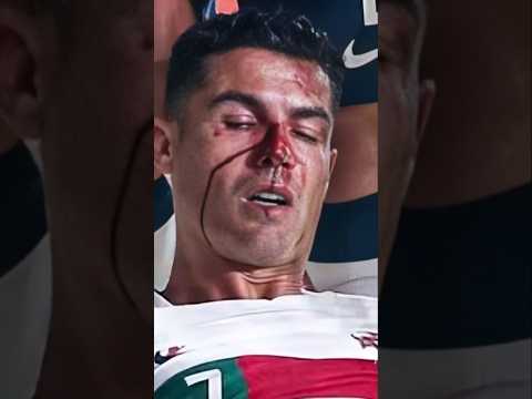 Ronaldo’s Serious Car Accident #shorts