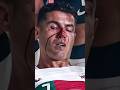 Ronaldo’s Serious Car Accident #shorts