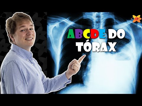 COMO AVALIAR QUALQUER RAIO X DO TÓRAX COM SEGURANÇA? O ABCDE DO TÓRAX I VOCÊ RADIOLOGISTA