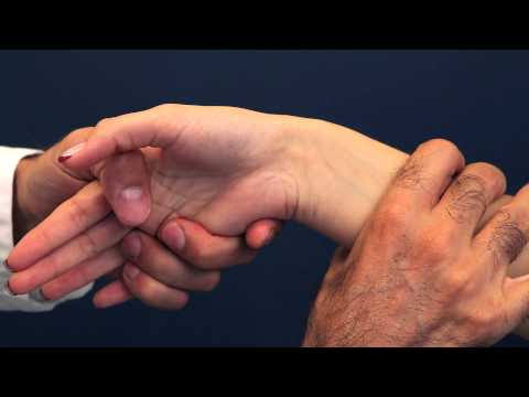 De Quervain's tenosynovitis