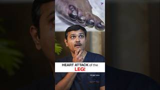 STOP Ignoring This Alarming Leg Pain Sign!