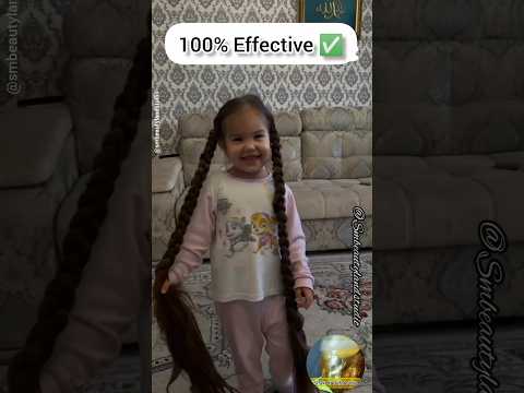 🌍Most Powerfull Herbal 🌿 Baby HAIR OIL ❤️ | Hair Growth Tips ✅ #shorts Smbeautylandstudio