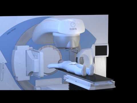How a linear accelerator works - Portuguese