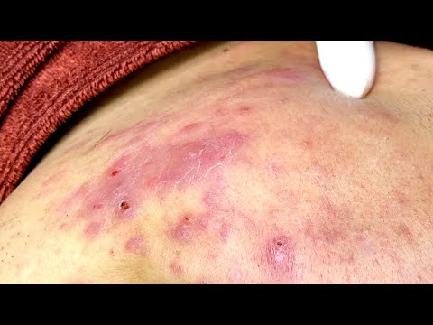 Relax Every Day With Sac Dep Spa #0072