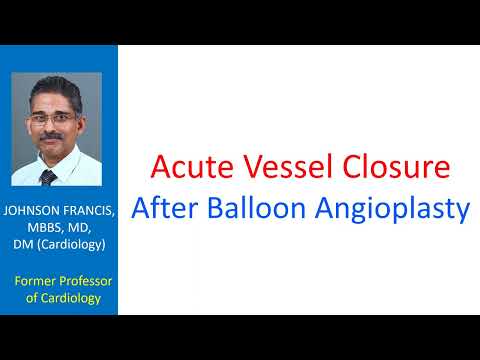 Acute Vessel Closure After Balloon Angioplasty