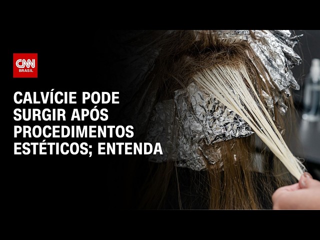 Procedimentos estéticos de salão podem levar a calvície? Dermatologista explica | CNN SINAIS VITAIS